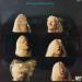 Johnny Winter - The Johnny Winter Story